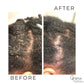 Seborrheic Dermatitis + Psoriasis Relief Duo